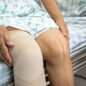 Senior citizen with scars from knee surgery